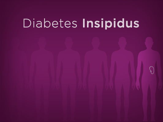 diabetes insipidus prevention)